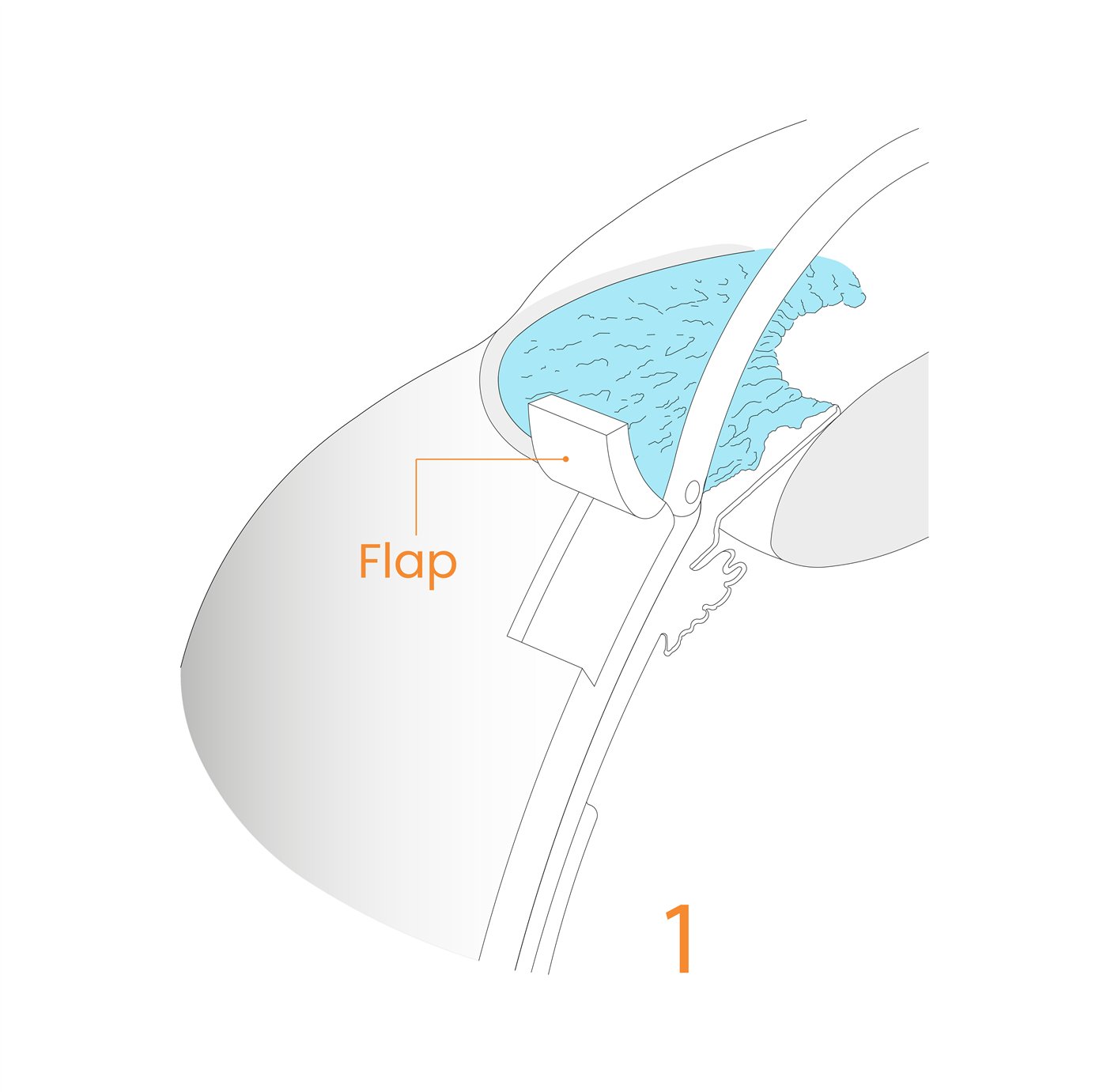 Implant procedure step 1